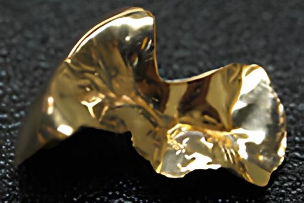 ゴールドインレー