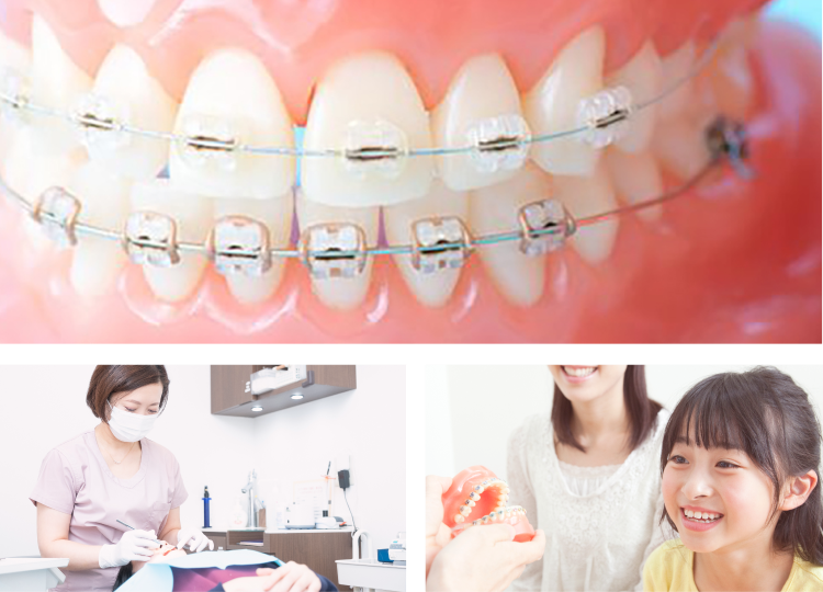 当院の矯正について