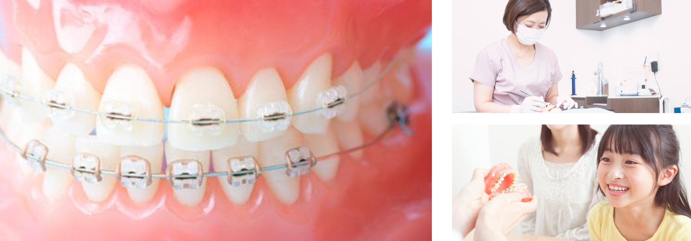 当院の矯正について